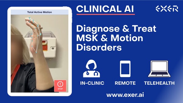 Exer AI Collaborates with Mayo Clinic to Advance Standard of Care for Hand and Wrist Disorders with AI