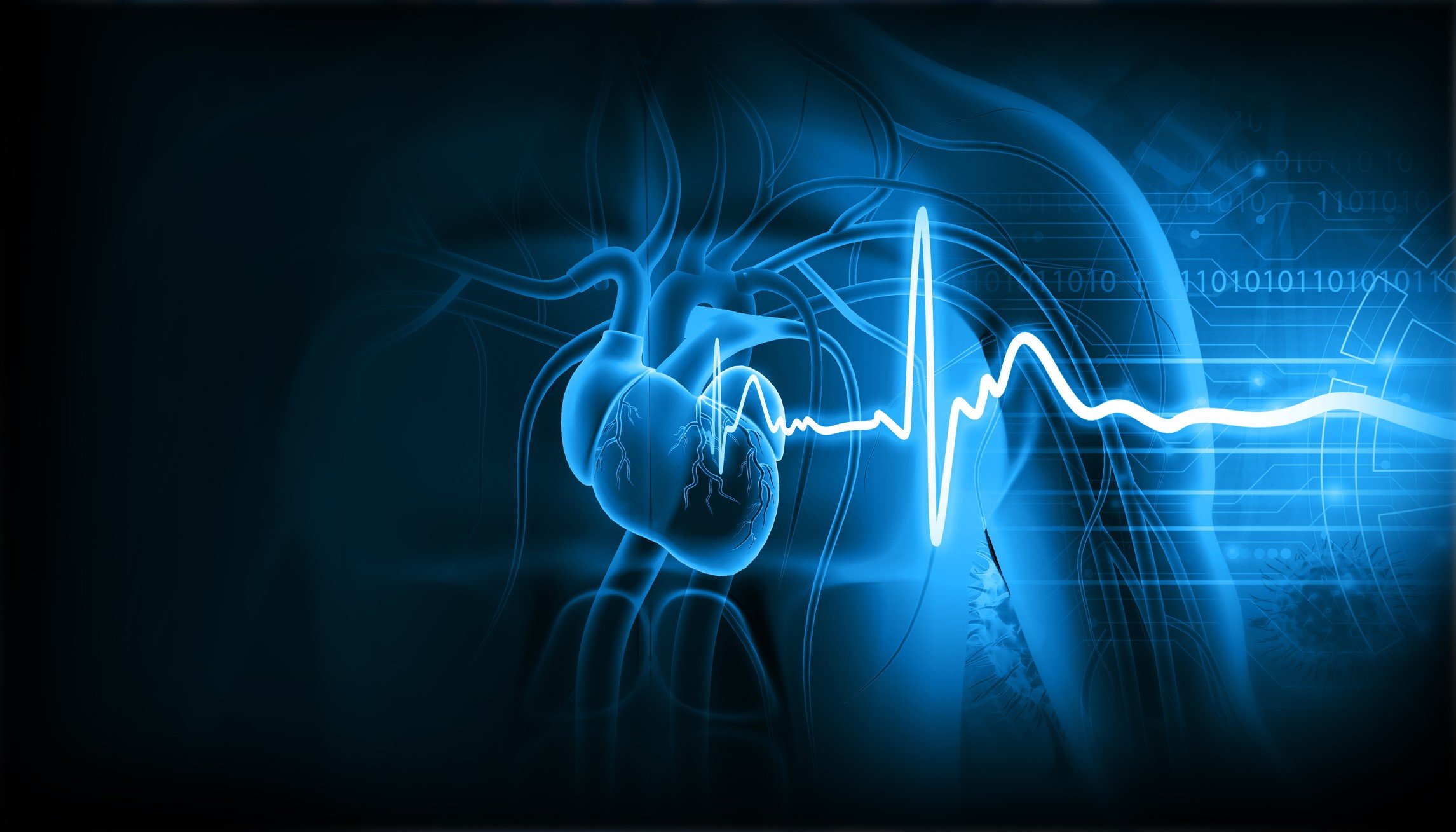 Viz.ai secures Bristol Myers Squibb's backing for hypertrophic cardiomyopathy-spotting AI