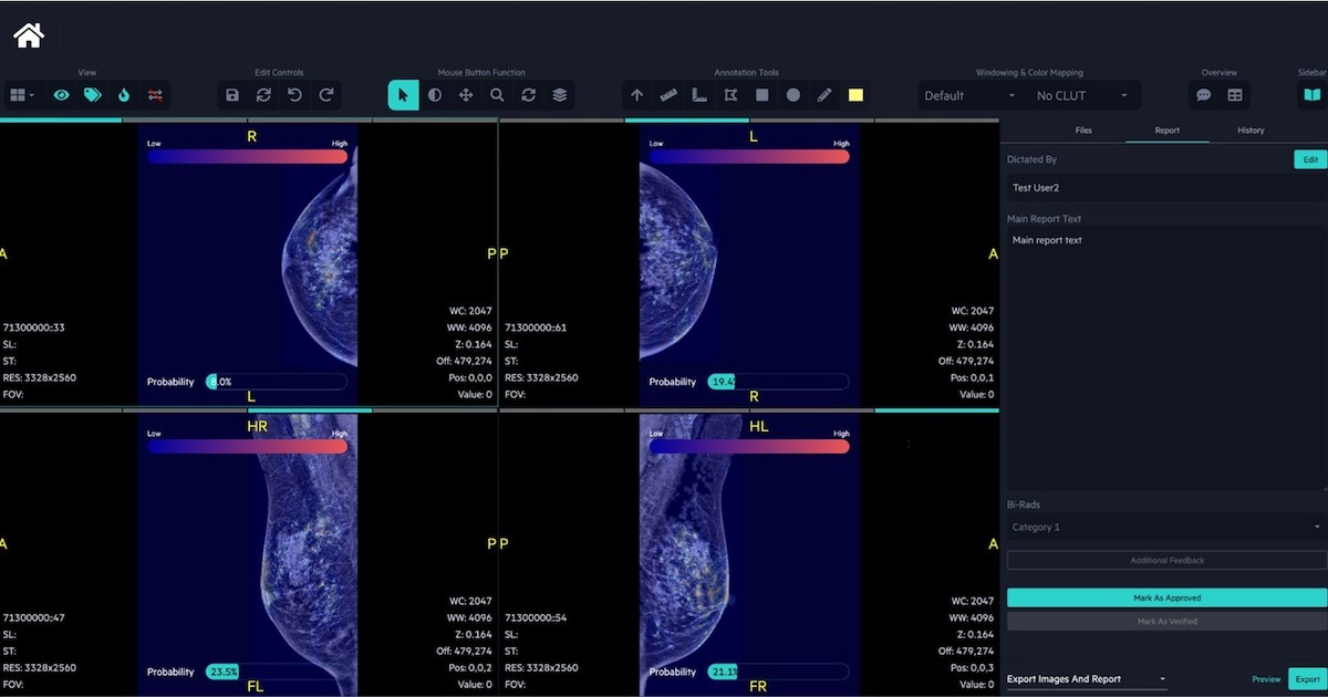 Singaporean startup FathomX scores almost $2M to hasten breast cancer AI development