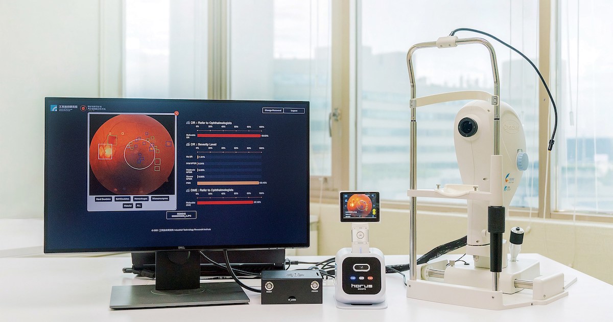 Taiwan-based non-profit develops AI software for diabetic eye disease diagnosis