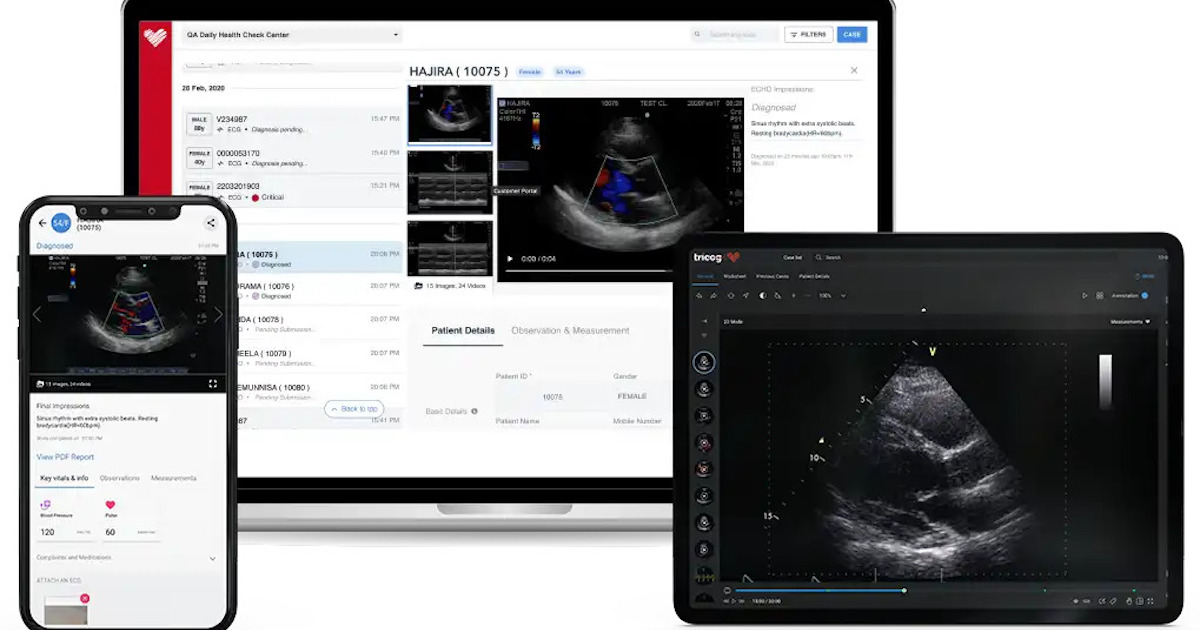 Roundup: AI cardiac solutions startup Tricog scores $9M funding and more briefs