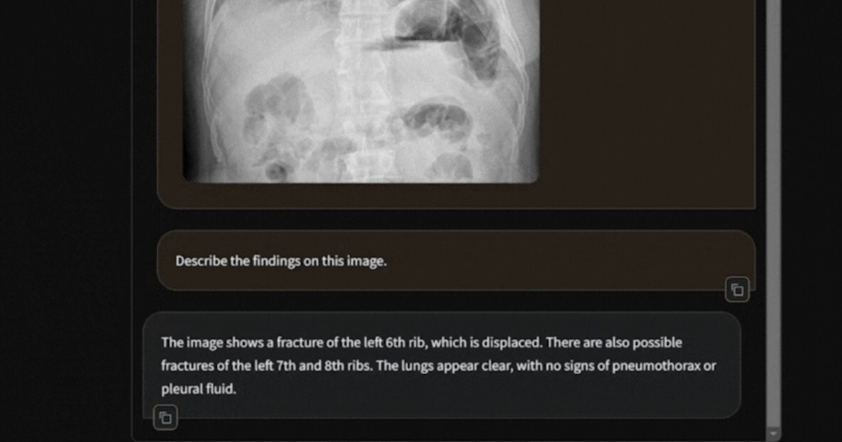 Harrison.ai introduces radiology genAI and more AI briefs