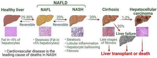 Pathogenesis of Non-alcoholic Fatty Liver Disease: Chinese Medical Journal Review Highlights Underlying Mechanisms and Therapeutic Approaches