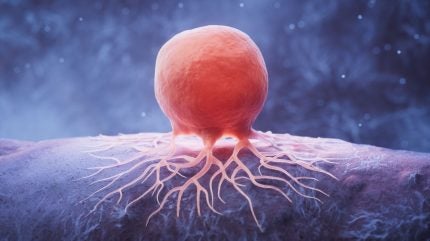 Carisma Therapeutics’ solid tumour therapy obtains FDA Fast Track status