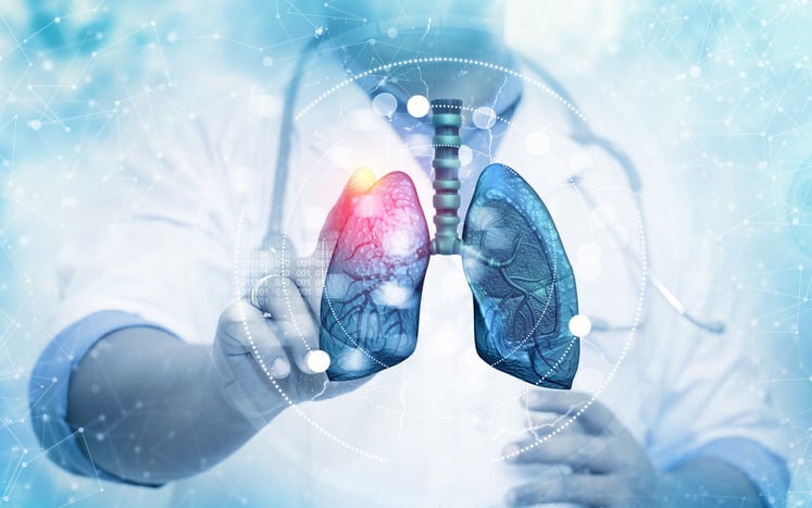 Cereno's HDAC inhibitor reduces risks from pulmonary arterial hypertension in phase 2 trial