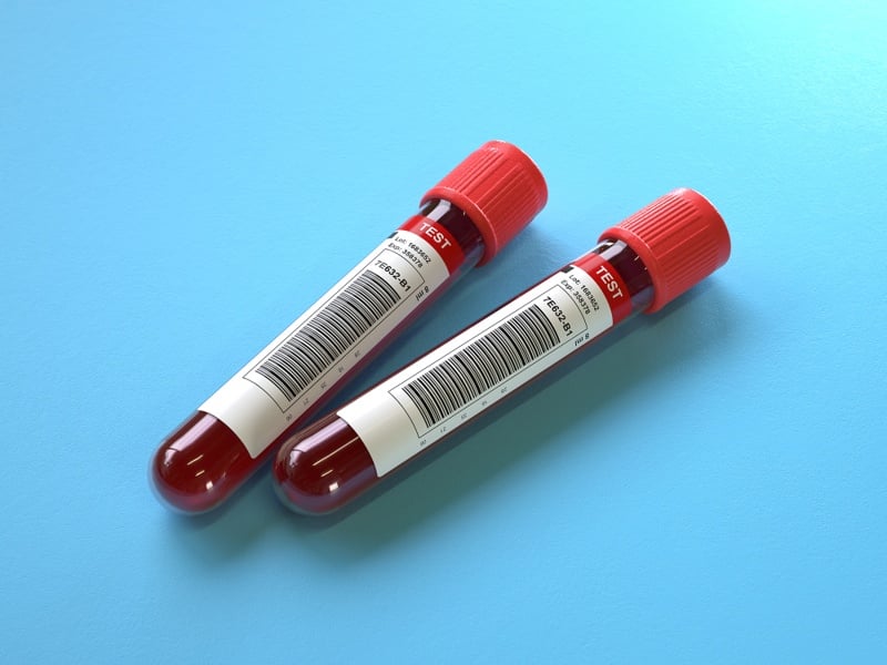 Delfi launches cancer-monitoring blood test alongside Immunocore collab