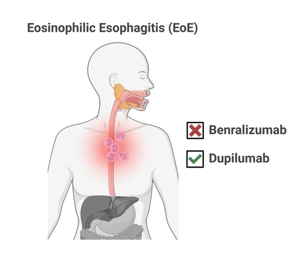 Two Studies Show Mixed Progress Against EoE