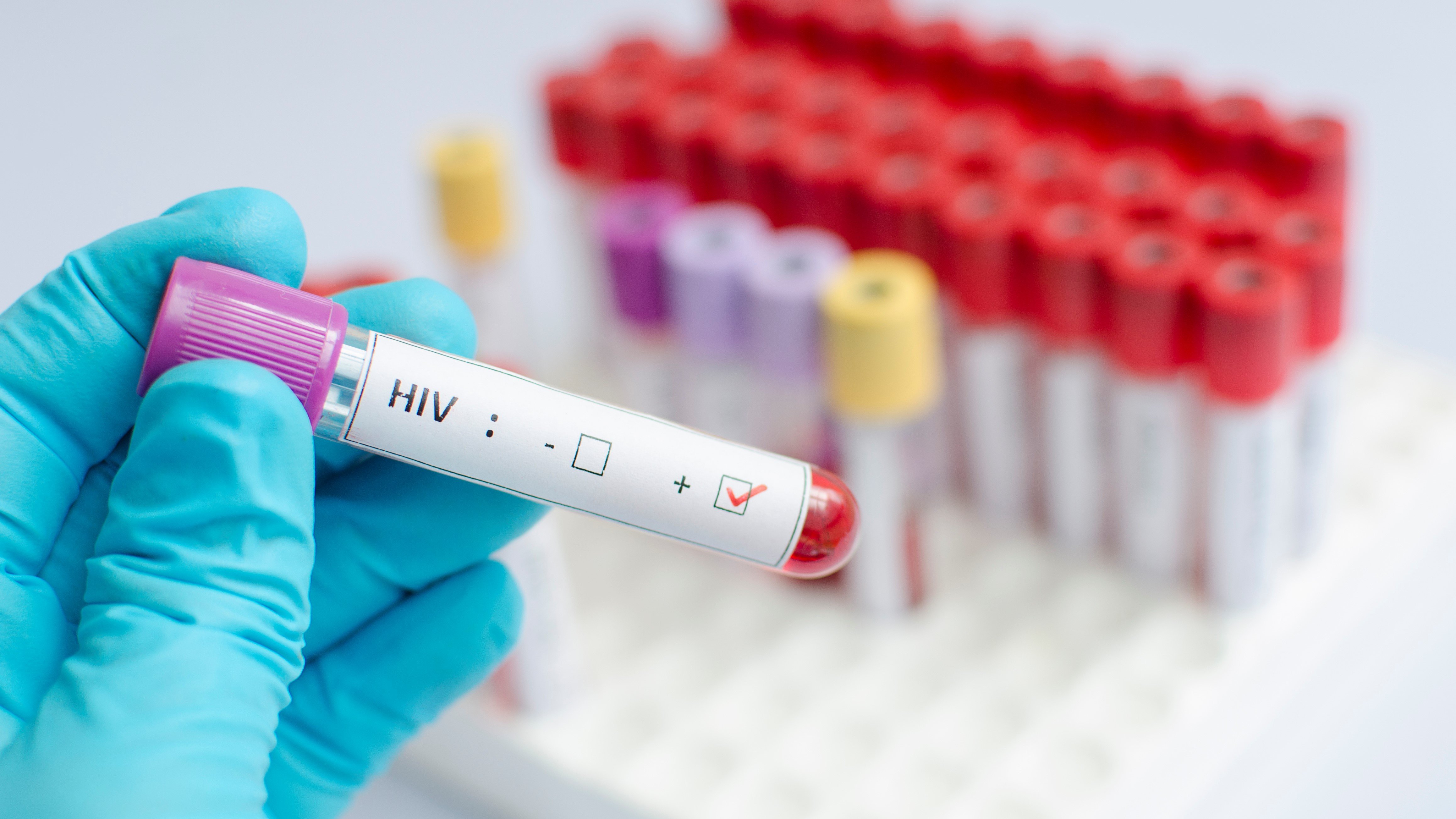 Merck finally gets FDA nod to relaunch HIV trials, but drops preventive therapy plans