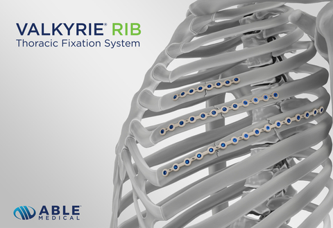 Able Medical Announces 510(k) Clearance of New RIB System Indicated for Thoracic Repair