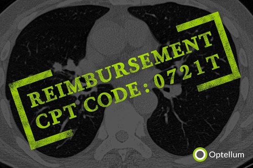 CMS Assigns New Technology Payment Classification for Optellum's Lung Cancer Prediction Score