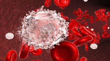 NUHS’s CD7 CAR-T cell therapy shows promise for leukaemia