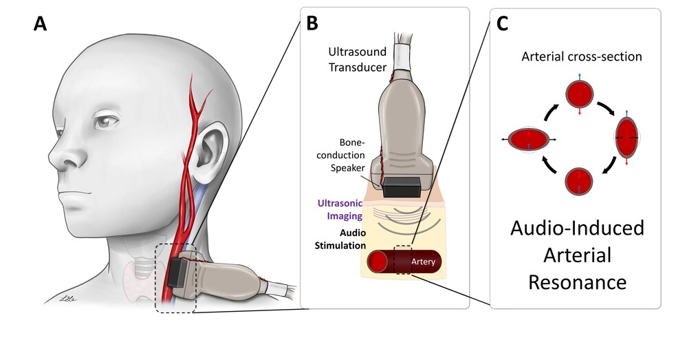 Esperto Medical Announces Study Results Measuring Blood Pressure with Sound