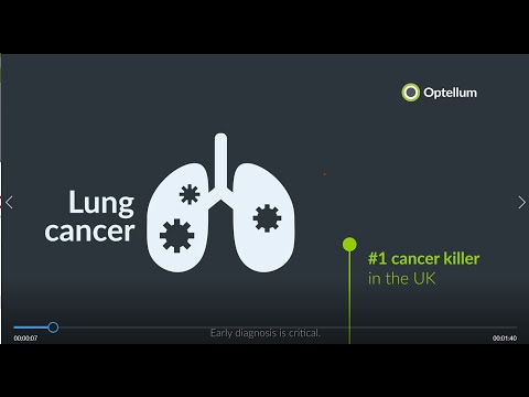Optellum, AI Lung Cancer Diagnosis Innovator, Secures $14M Series A Funding to Accelerate Expansion