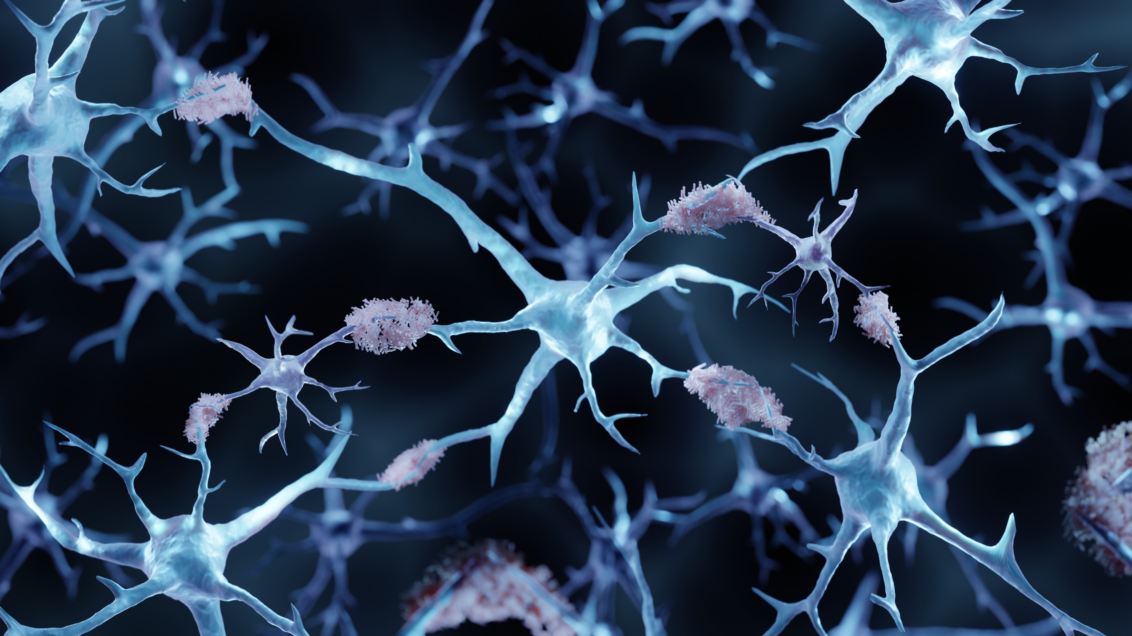 Returning the complement: Protein's role in pathway could bolster new Alzheimer's approach