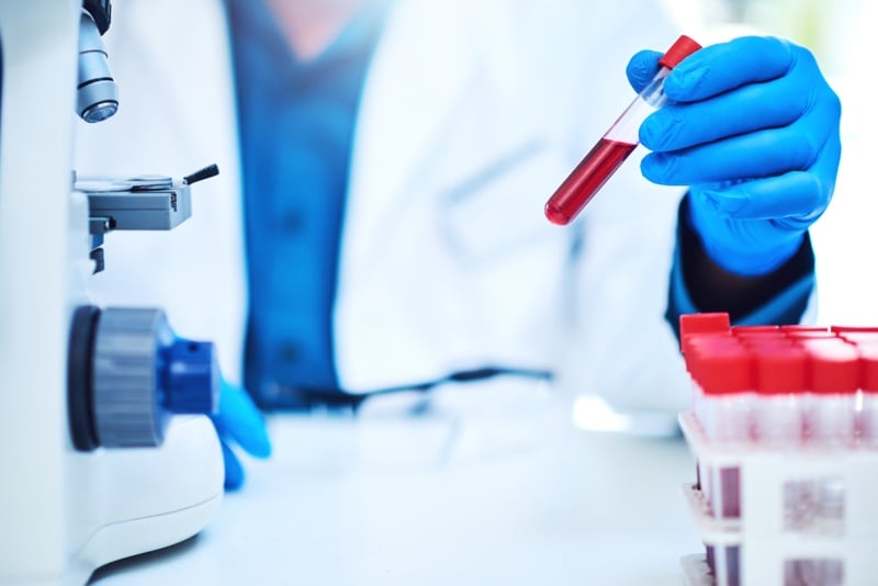 Clinical lab industry sues to block FDA's new oversight of lab-developed tests 