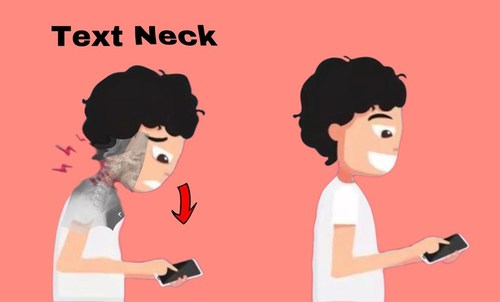Fix Text Neck with Chiropractic, Study Suggests Chiropractor-Approved Maintenance Care