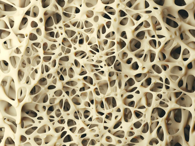 In boost to Amgen, analysts predict osteoporosis market share shift