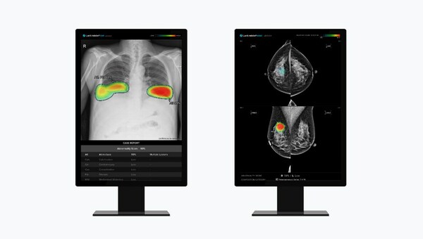 Lunit Expands AI Medical Imaging Solutions in East & Southeast Asia: Partners with Chung Shan Medical University and Gleneagles Hospital Singapore