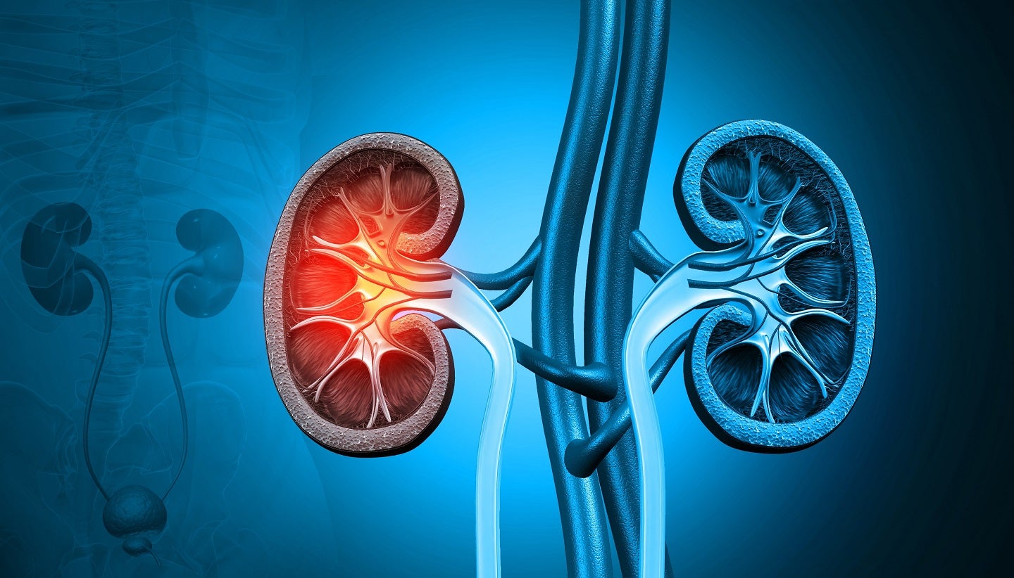 NephroDI Therapeutics and MSRD partner to develop therapy for NDI