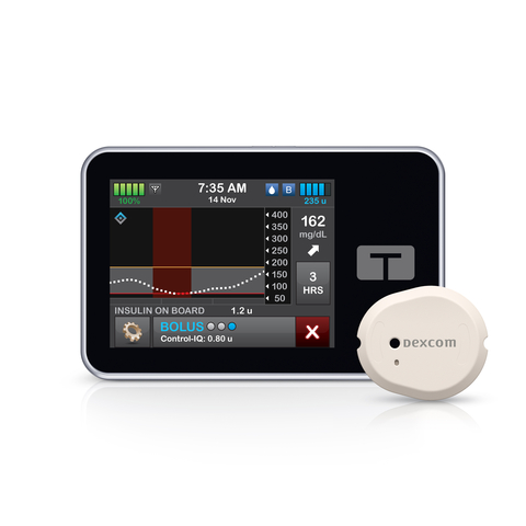 Dexcom G7 is Now the Most Accurate, Smallest, Easy-to-Use CGM Connected to the Tandem t:slim X2 Insulin Pump