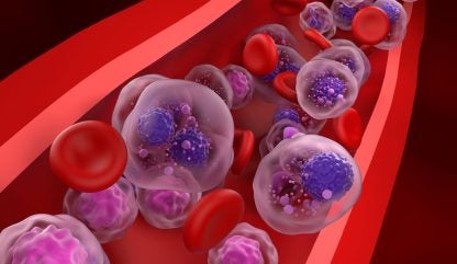 CARsgen’s CAR-T therapy for multiple myeloma gains NMPA approval