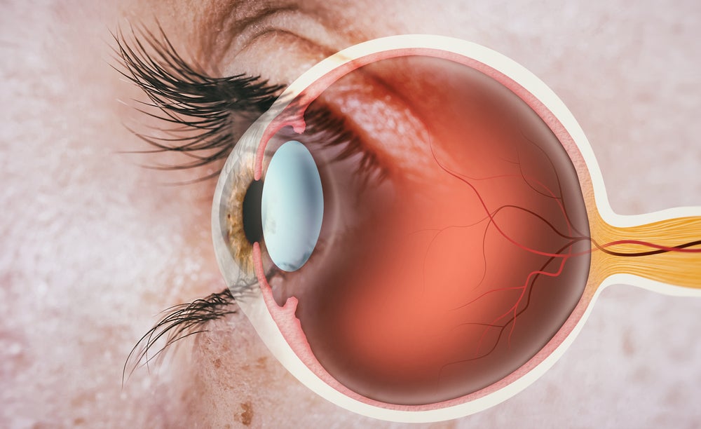 SparingVision shares trial updates for rare eye disease gene therapies