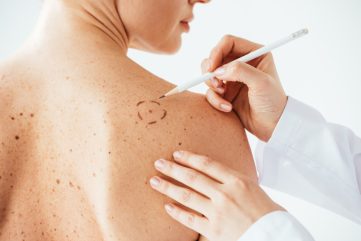 Immunocore and BMS partner to investigate first-line treatment for melanoma