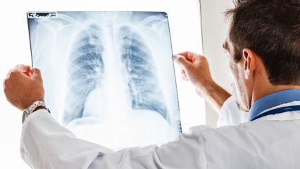 Janssen seeks EMA approval of RYBREVANT for NSCLC