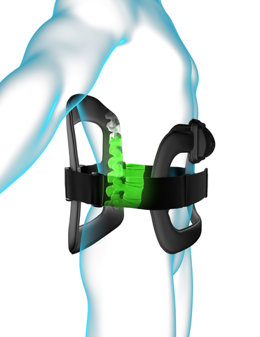 Orthofix Announces Publication of New Data Supporting Use of PEMF Stimulation in Lumbar Spine Fusion Procedures for Patients at Risk of Pseudarthrosis
