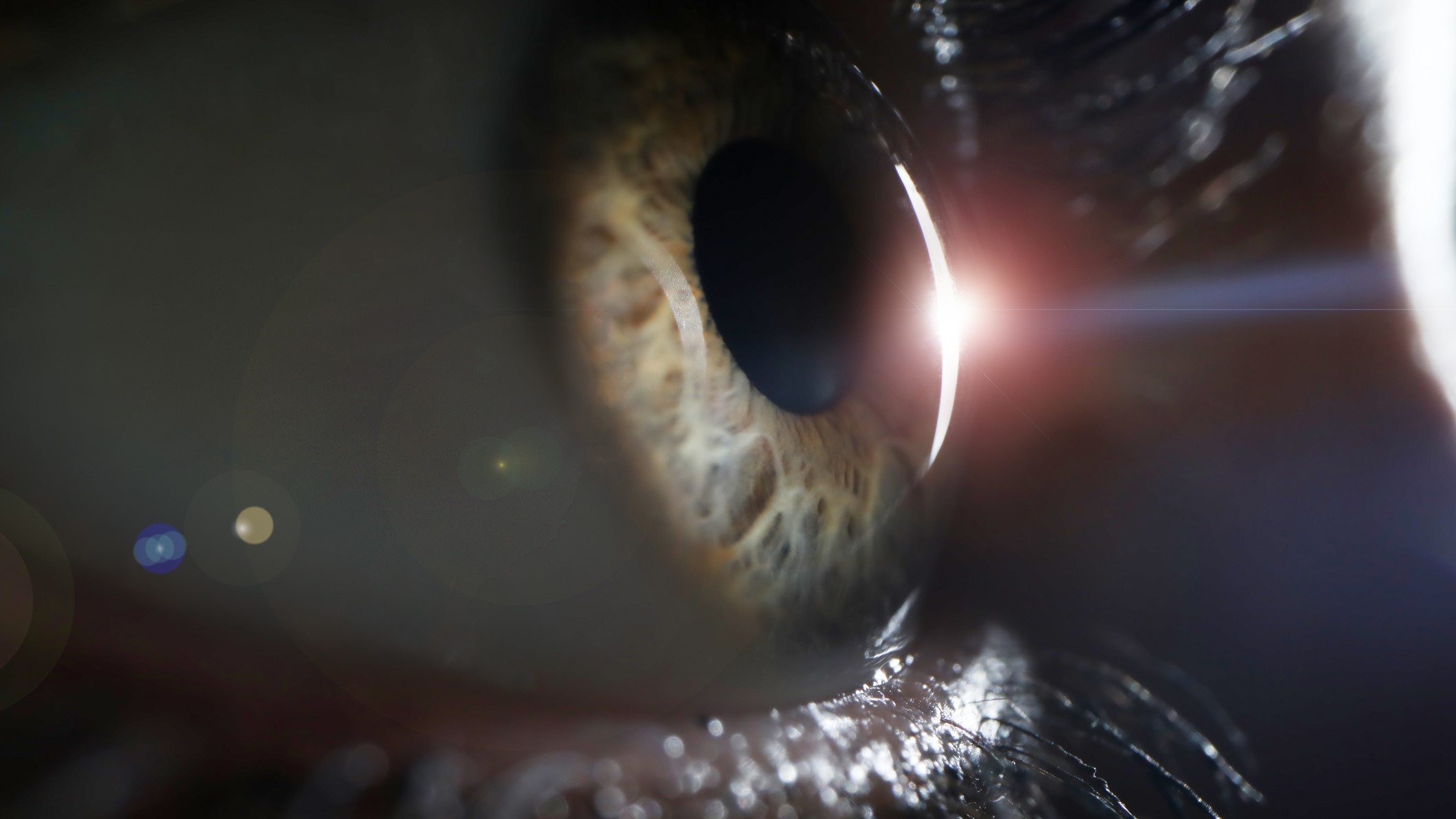 Skye Bioscience ends eye disease R&D efforts after glaucoma drug's phase 2 fail